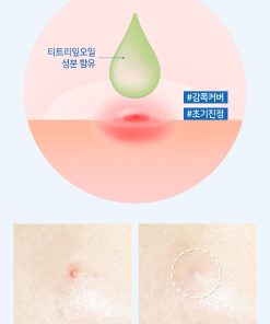 Review Miếng dán trị mụn Dr. Belmeur Clarifying Spot Soothing Patches The Face Shop