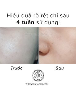 Hướng dẫn sử dụng Tinh chất Tràm Trà ngừa mụn se khít lỗ chân lông Tea Tree Pore Ampoule The Face Shop 30ml